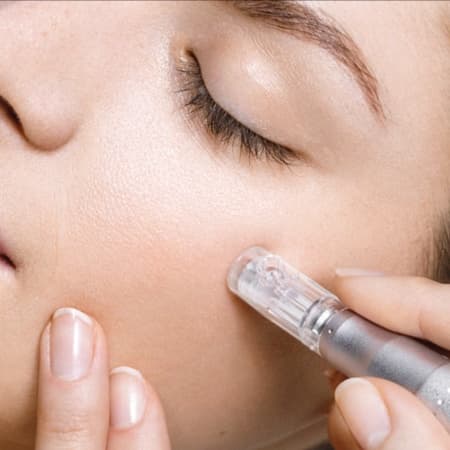 Microneedling Face + Neck at B3 Beauty Salon LLC in Joplin, MO